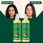 Vynnzo Complete Transformation Kit™