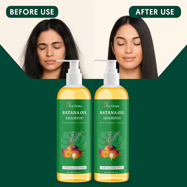 Vynnzo Complete Transformation Kit™